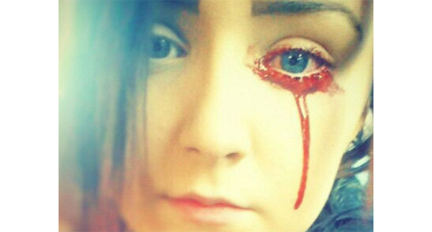 El extraño caso de la niña que llora sangre - 1