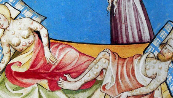 Enfermedades que fueron consideradas una aberración en la Edad Media - 2