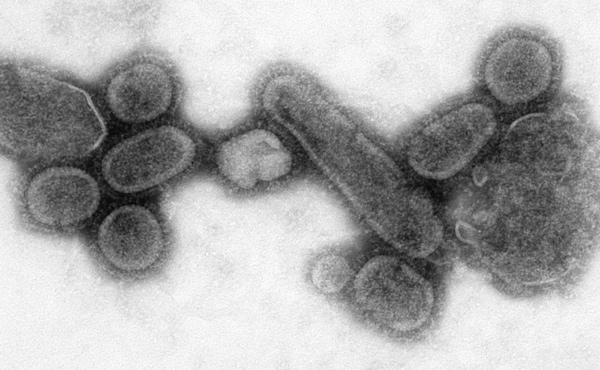 Cómo lograron identificar el primer virus de la historia - 2